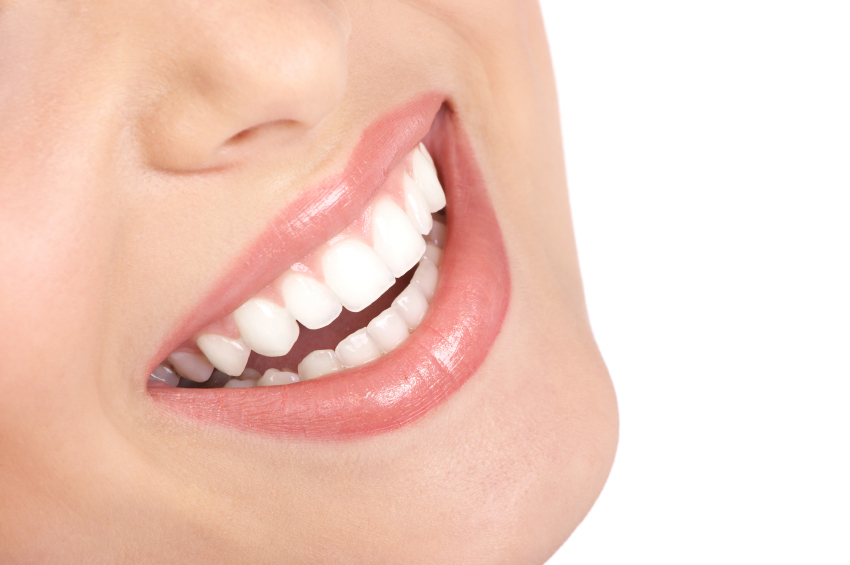 Are Porcelain Veneers Right for You? | La Jolla CA
